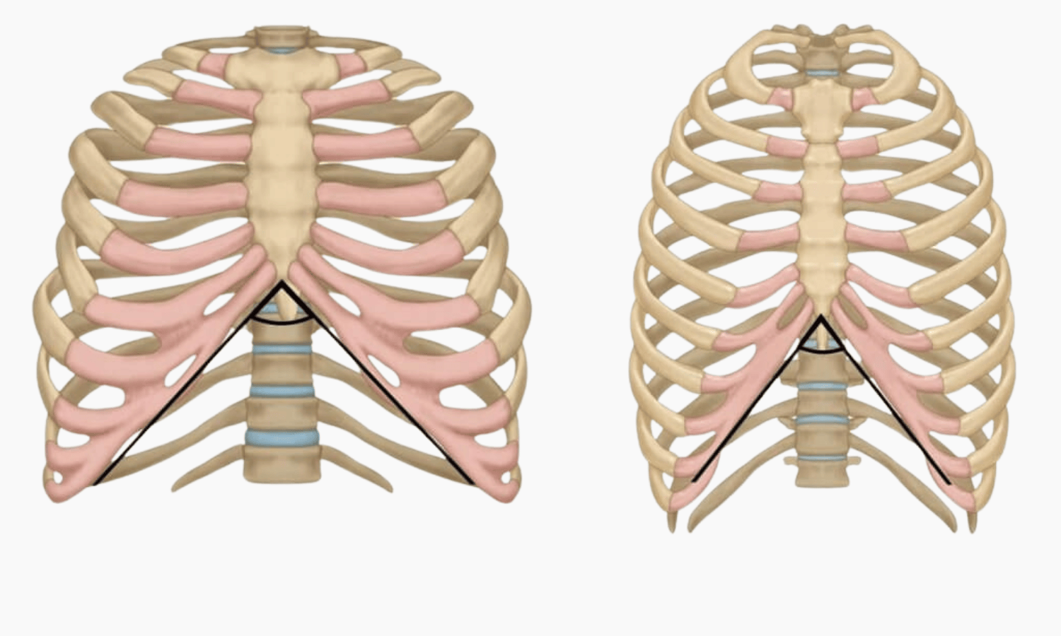 Epigastrischer Winkel